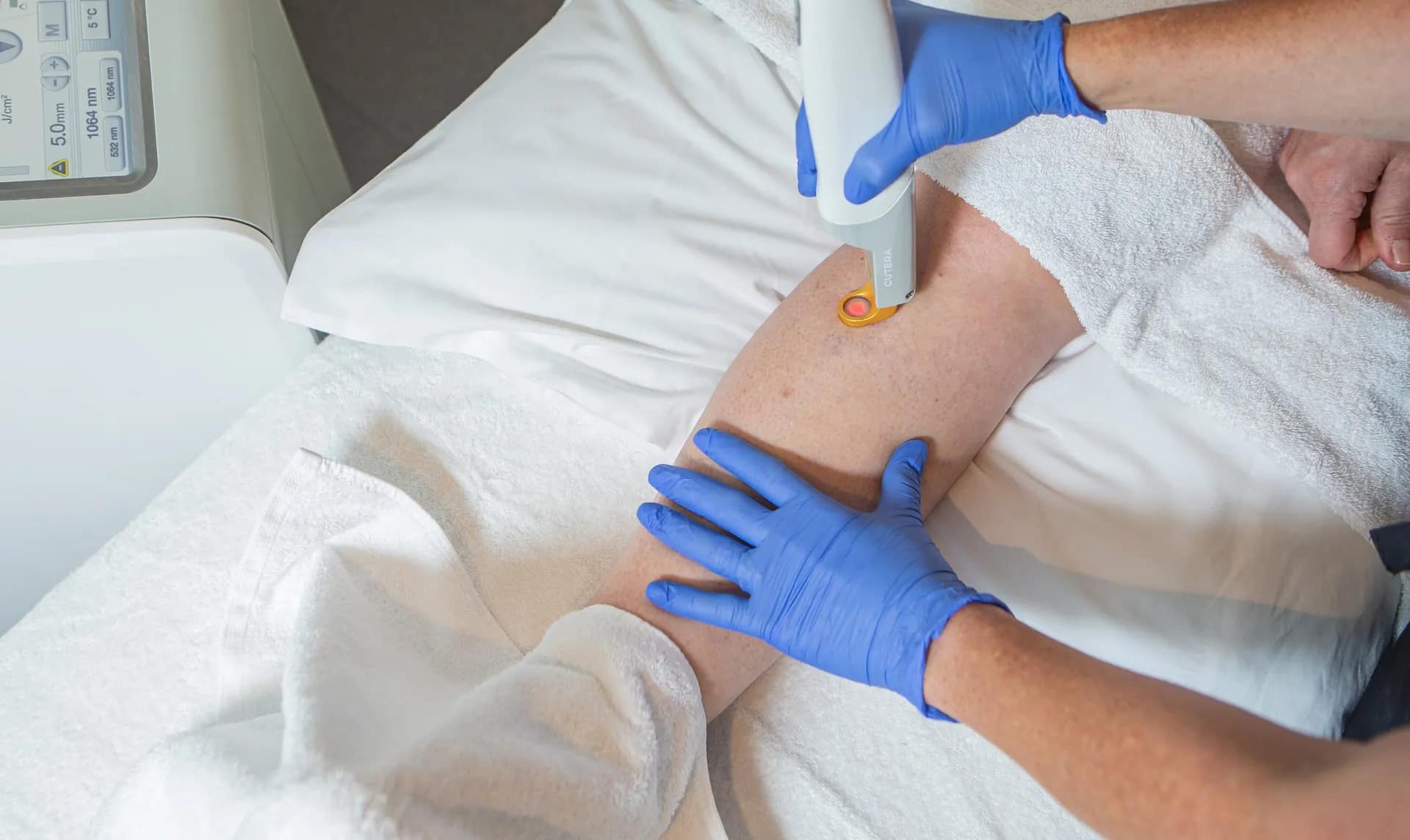Omni-Channel Marketing for Vein Treatment Clinic Growth
